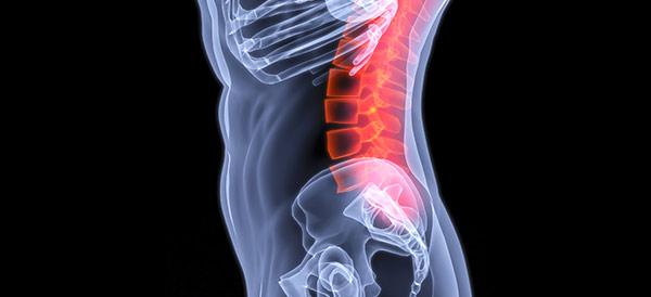 Spinal Cord Injuries